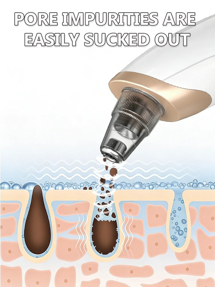 Blackhead remover, pimple and blackhead vacuum cleansing device for facial skin, for deep cleansing at home.