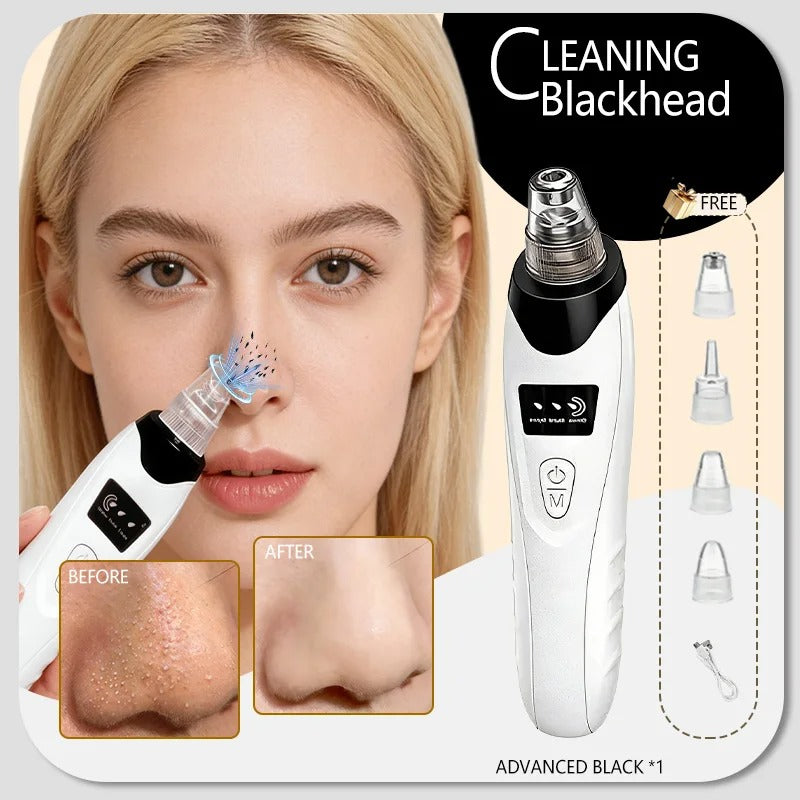 Blackhead remover, pimple and blackhead vacuum cleansing device for facial skin, for deep cleansing at home.