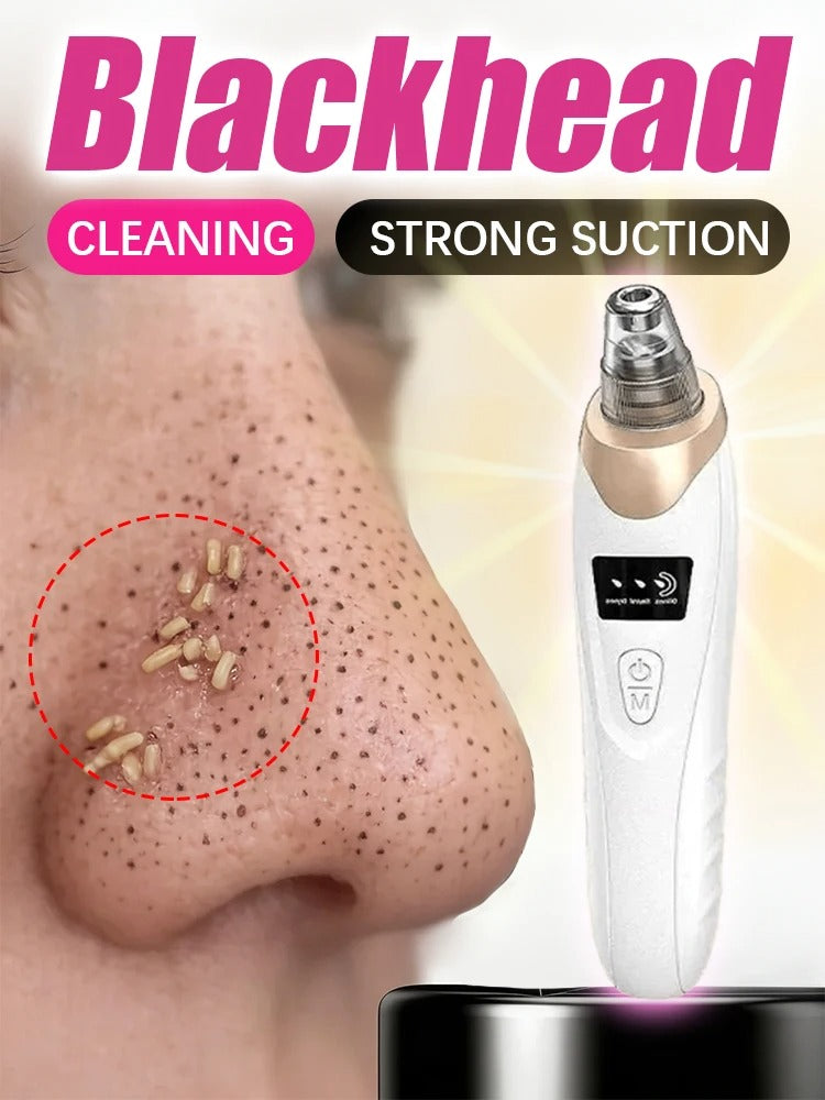 Blackhead remover, pimple and blackhead vacuum cleansing device for facial skin, for deep cleansing at home.