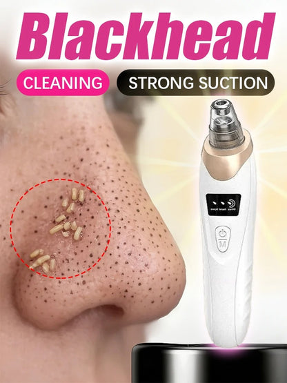 Blackhead remover, pimple and blackhead vacuum cleansing device for facial skin, for deep cleansing at home.