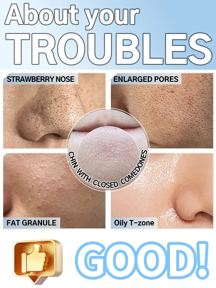Blackhead remover, pimple and blackhead vacuum cleansing device for facial skin, for deep cleansing at home.