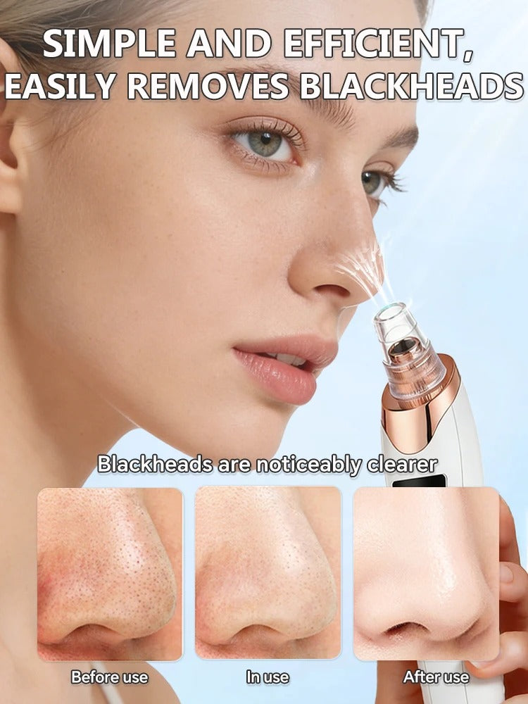 Blackhead remover, pimple and blackhead vacuum cleansing device for facial skin, for deep cleansing at home.