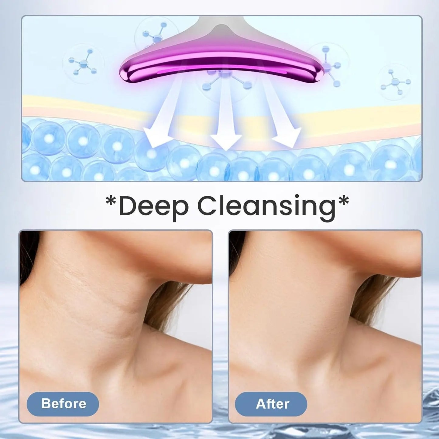 Neck Face Lifting Massager Skin Rotating Device LED Phototherapy Anti-Wrinkle Remover