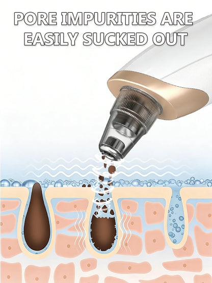 Blackhead remover, pimple and blackhead vacuum cleansing device for facial skin, for deep cleansing at home.