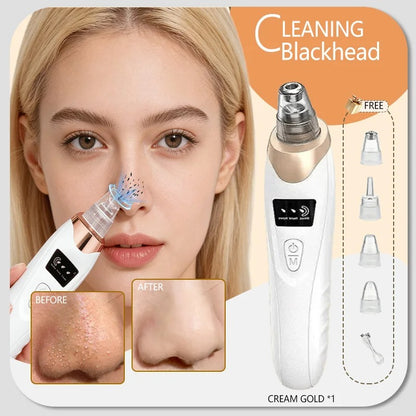 Blackhead remover, pimple and blackhead vacuum cleansing device for facial skin, for deep cleansing at home.