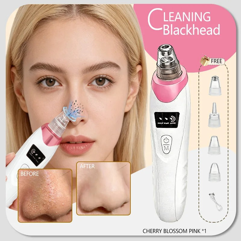 Blackhead remover, pimple and blackhead vacuum cleansing device for facial skin, for deep cleansing at home.